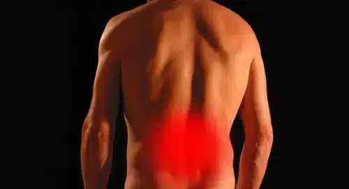 טיפול בכאבי גב עם סידן